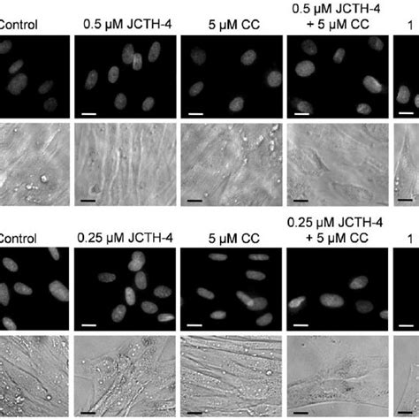 JCTH 4 And CC Do Not Yield Apoptotic Morphology In HOb And NFF Cells