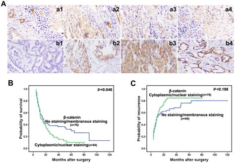 Immunohistochemical Analysis Of B Catenin In Icc And Adjacent Download Scientific Diagram