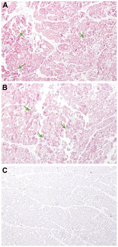 Immunohistochemical Detection Of Enteroviral Capsid Protein VP1 In