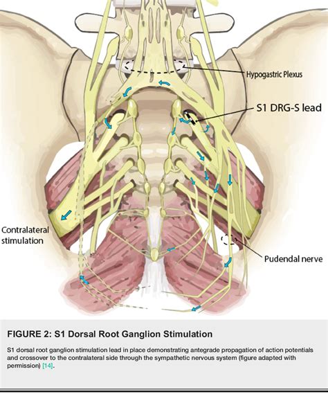 Dorsal Root Ganglion Location