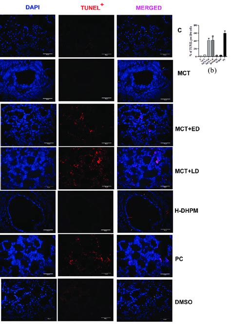 H Dhpm Induces Apoptosis In Lung Parenchyma And Lung Vasculature A