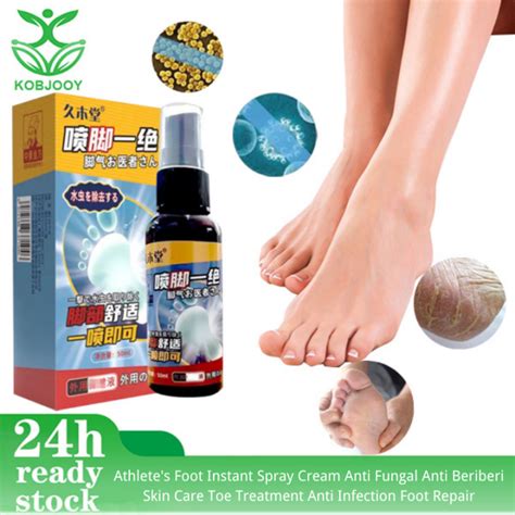 Athletes Foot Instant Spray Cream Anti Fungal Anti Beriberi Skin Care