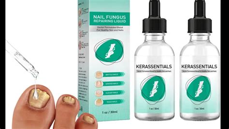 Kerassentials Reviews Beware Oil For Toenail Fungus Read Before Buying