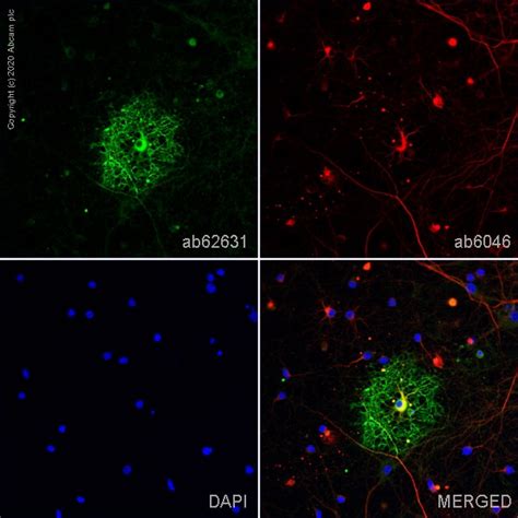 Anti Myelin Basic Protein Antibody Mbp Bsa And Azide Free Ab