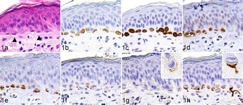 Clinical And Pathologic Study Of Feline Merkel Cell Carcinoma With