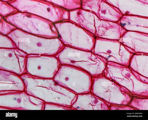 Light photomicrograph of an Onion epidermus cells seen through a ...