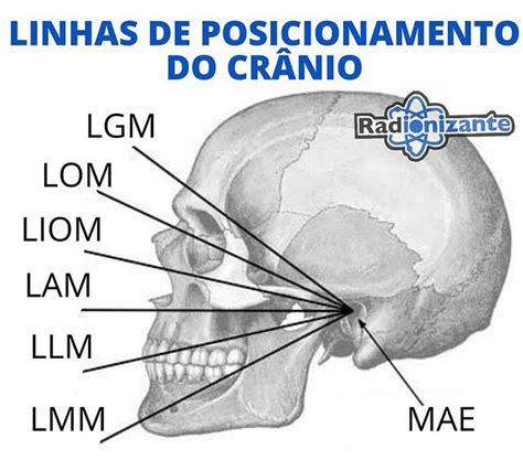 Simon Gon Alves Radiologia No Instagram Linhas Usadas No