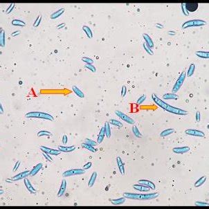 a) Microconidia, b) Macroconodia | Download Scientific Diagram