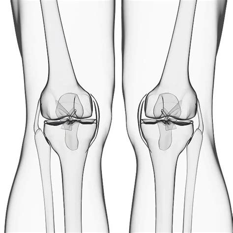 Human Leg Bones Artwork F Our Beautiful Pictures Are