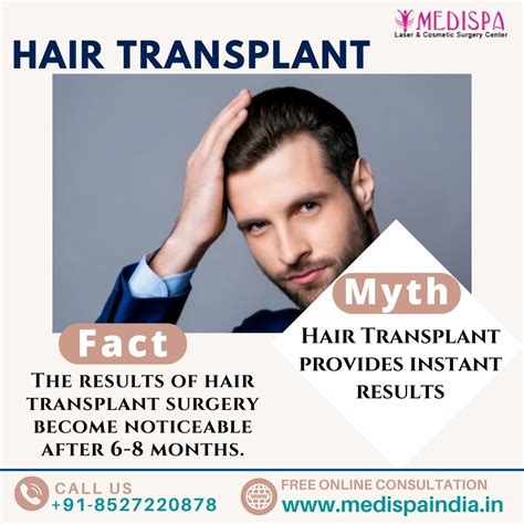 Hair Transplant Myths Facts Artofit