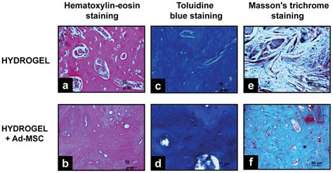 Histological Analysis Of Bone Regeneration By Implanting HBPHs With