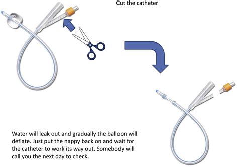 Parental Home Removal Of Urethral Catheters After Urological Surgery—a