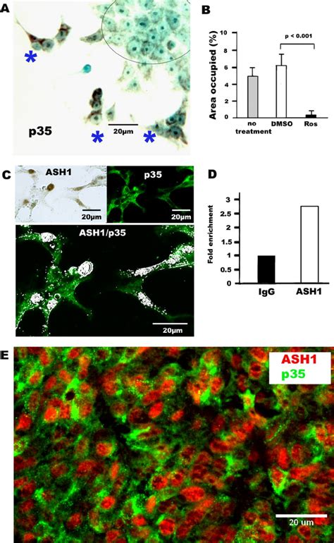 P35 Is A Direct Target Of HASH1 Regulates Migration In Human SCLC Cell