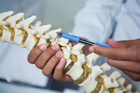 Espondilose Cervical O Que Sintomas E Como Tratar Mundoboaforma