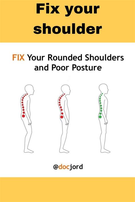 Fix Your Rounded Shoulders And Poor Posture Artofit