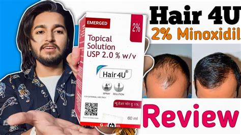 Hair U Minoxidil Solution Review Hairfall Treatment Bald To Dense