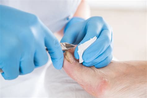 Craig Barrell Podiatry - Home Visit Podiatry Service