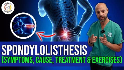 Spondylolisthesis (Symptoms, Cause, Treatment & Exercises) - YouTube