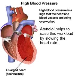 What Is Atenolol? - Uses & Side Effects | Study.com