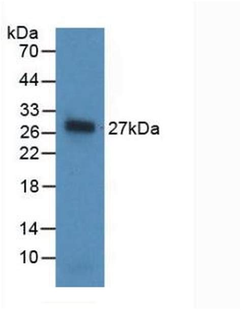 Noggin Monoclonal Antibody A11 Ma5 41654