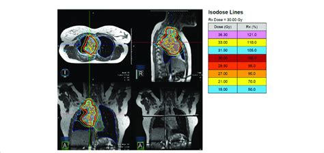 A patient with Stage IV ALK-rearranged non-small cell lung cancer and a ...