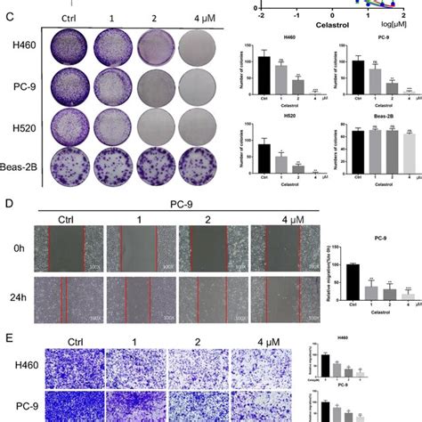 Celastrol Inhibited The Viability Migration And Invasion Of Nsclc