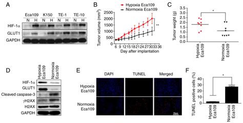 Prognostic Impact Of The Combination Of Hif‑1α And Glut1 In Patients