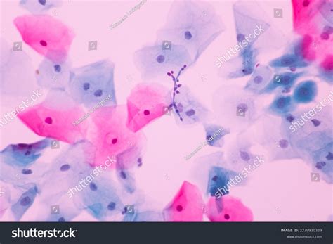 3+ Thousand Candida Fungus Royalty-Free Images, Stock Photos & Pictures ...