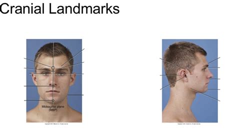 Cranial Landmarks Diagram Quizlet