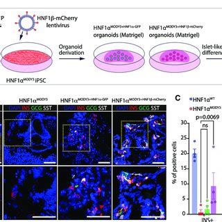 HNF1b Overexpression Partially Rescues The B Cell Differentiation