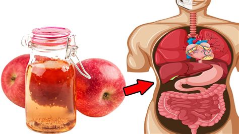 If You Drink Apple Cider Vinegar See What Happens To Your Body Healthpedia Youtube