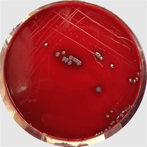 Staph Epidermidis On Blood Agar