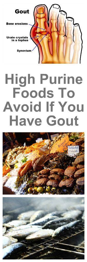 19 High Purine Foods To Avoid If You Have Gout