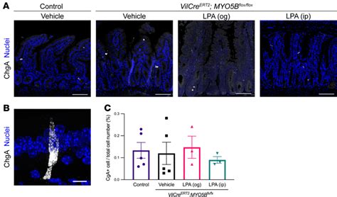 Lack Of Changes In The Frequency Of Enteroendocrine Cells In