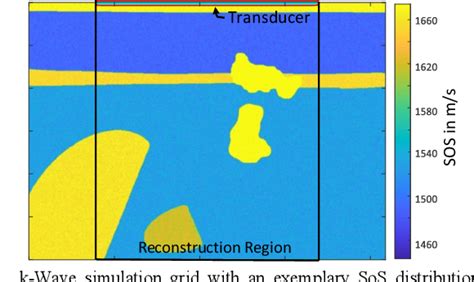 Figure 1 From Deep Learning Based Speed Of Sound Reconstruction For