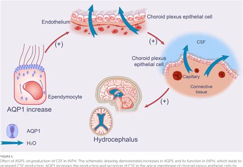 Figure 1 From The Pathogenesis Of Idiopathic Normal Pressure Hydrocephalus Based On The