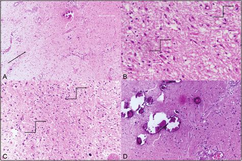 Histopathological Microphotographs With H E Stain A Biphasic