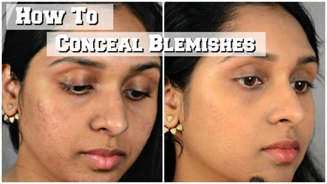 How To Cover Acne Scars Blemishes With Makeup YouTube