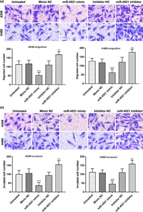 Prognostic Value Of MicroRNA 4521 In Non Small Cell Lung Cancer And Its