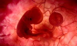 Feto de 3 meses