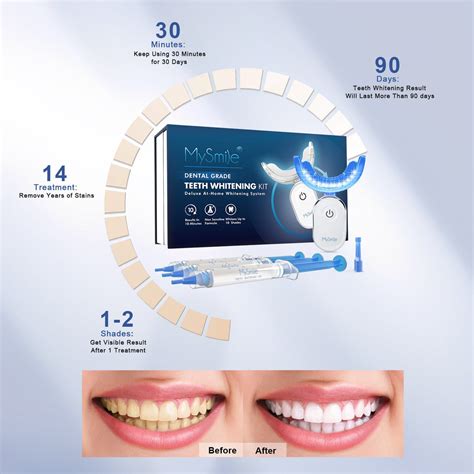 Shop MySmile Pro Teeth Whitening Kit | Get Brighter Smile in 2 Weeks