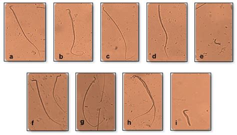 The Sprague Dawley Rats Sperm Morphology Ie Normal And Abnormal