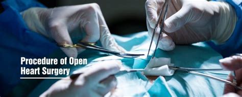 What To Expect When You’re Having Open Heart Surgery Healing Hospital