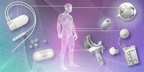 Smart Implants Making Major Impact In The Medical World