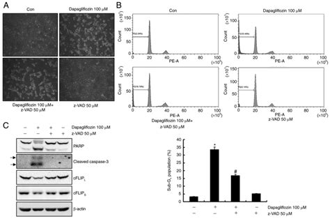 Dapagliflozin Induces Apoptosis By Downregulating Cfilp L And