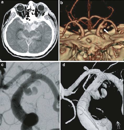 The initial brain CT scan, which was obtained immediately following the... | Download Scientific ...