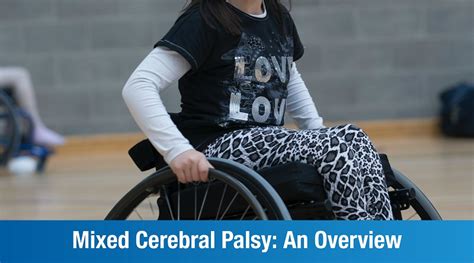 Mixed Cerebral Palsy: Causes, Symptoms and Treatment | Plexus