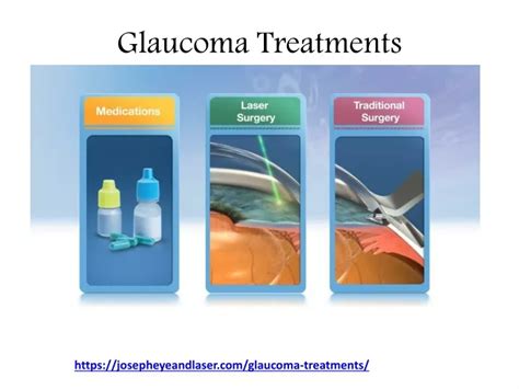 Ppt Glaucoma Treatments Powerpoint Presentation Free Download Id