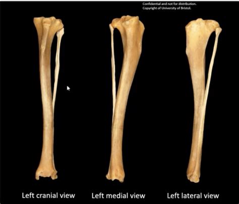 Tibia and fibula Diagram | Quizlet