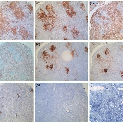 Immunohistochemistry And In Situ Hybridisation Ish Of Sections Of The